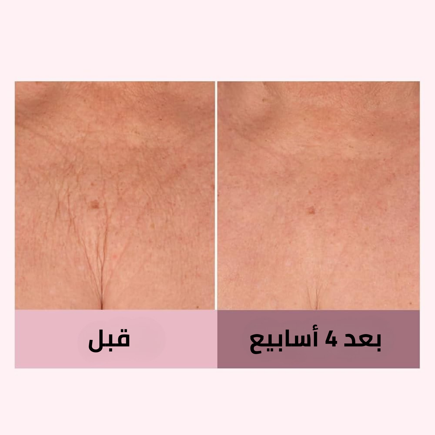 كريم تشامباغن بيوتي ليفت - السر الفاخر لشد البشرة وإشعال إشراقتك!