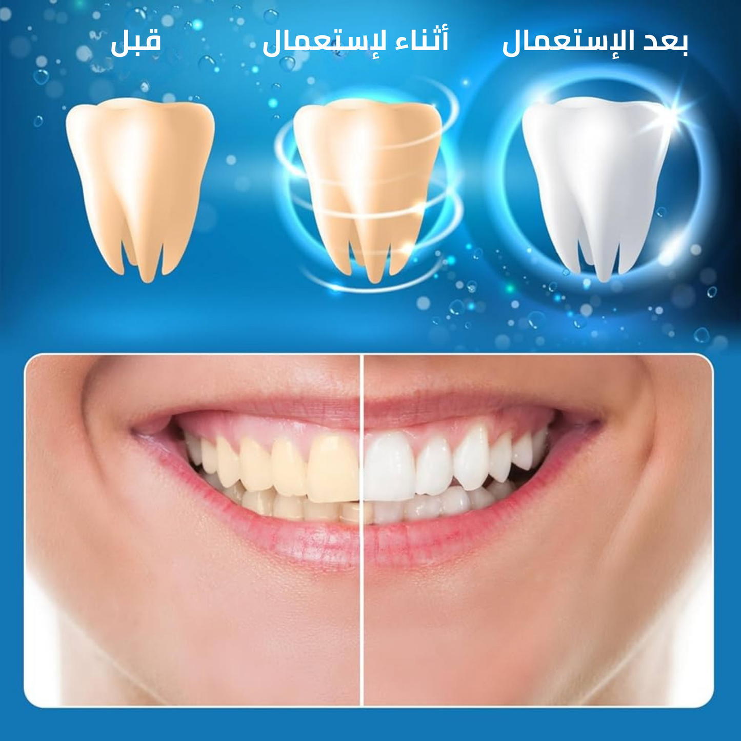 شرائط تبييض الأسنان 5D: السر الخفي لابتسامة هوليوودية تجذب كل الأنظار